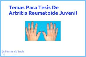 Tesis de Artritis Reumatoide Juvenil: Ejemplos y temas TFG TFM