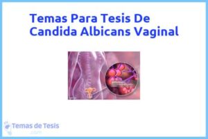 Tesis de Candida Albicans Vaginal: Ejemplos y temas TFG TFM
