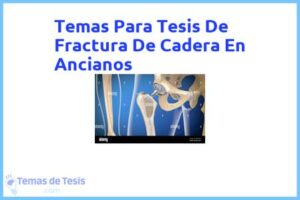 Tesis de Fractura De Cadera En Ancianos: Ejemplos y temas TFG TFM