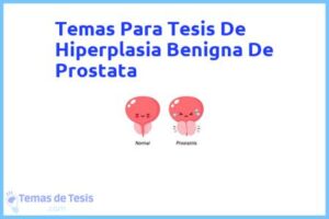 Tesis de Hiperplasia Benigna De Prostata: Ejemplos y temas TFG TFM