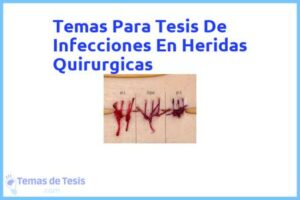 Tesis de Infecciones En Heridas Quirurgicas: Ejemplos y temas TFG TFM