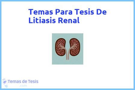 temas de tesis de Litiasis Renal, ejemplos para tesis en Litiasis Renal, ideas para tesis en Litiasis Renal, modelos de trabajo final de grado TFG y trabajo final de master TFM para guiarse