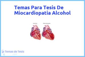 Tesis de Miocardiopatia Alcohol: Ejemplos y temas TFG TFM